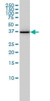 AKR1A1 Antibody (clone 1A11-2A4)