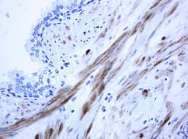 ICT1 / DS1 Antibody (clone OTI2F9)