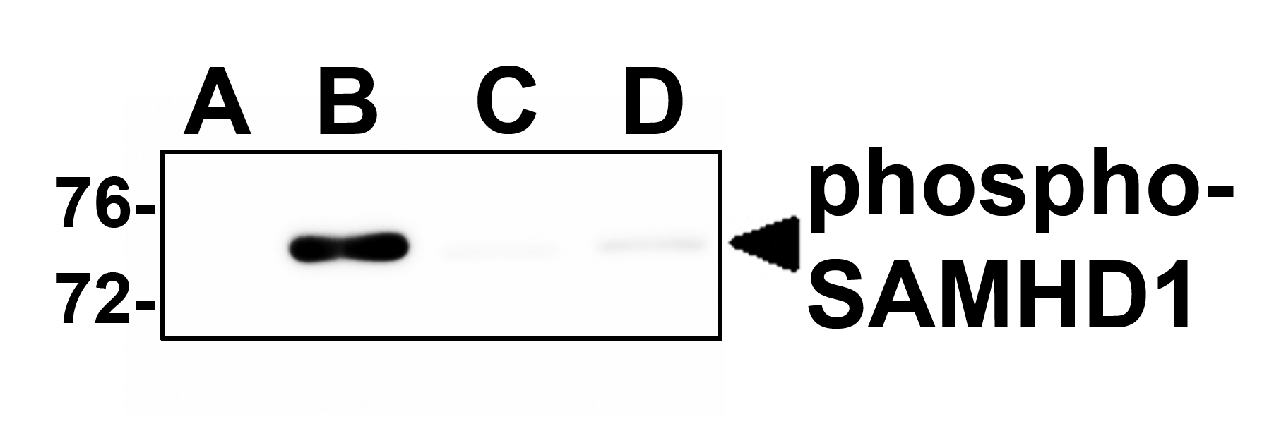 SAMHD1 Antibody (phospho-Thr592)