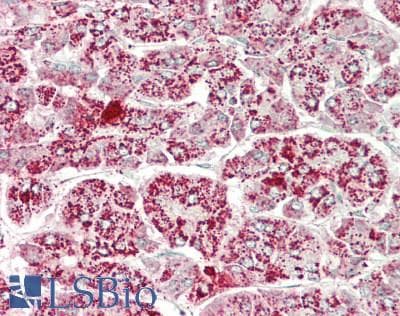 IHC-plus™ Polyclonal Rabbit anti-Human ATP5A1 / ATP Synthase Alpha Antibody (IHC, IF, WB)