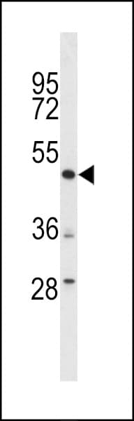 DEK Antibody (aa336-364)