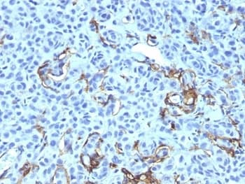 NGFR / CD271 / TNR16 Antibody (clone NGFR5 + NTR/912, Ready-to-Use)