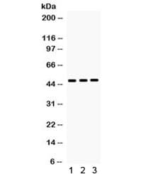 Polyclonal Rabbit anti-Human HHEX / HEX Antibody (WB)