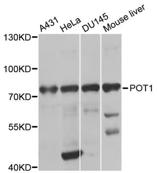 POT1 Antibody