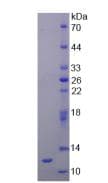 Rat REN / Renin 1 Protein (Recombinant His, N-Terminal)