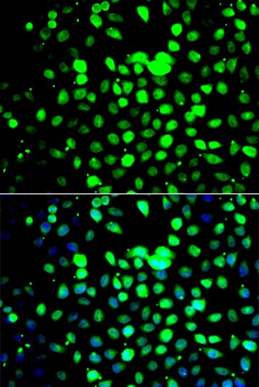 Polyclonal Rabbit anti-Human ZBTB25 Antibody (IHC, IF, WB)