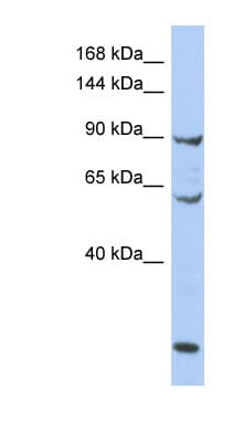 MCM8 Antibody (aa71-120)
