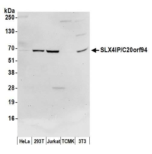 Polyclonal Rabbit anti-Human SLX4IP / C20orf94 Antibody (aa25-75, WB)