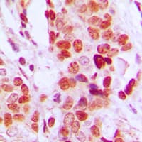 DDX52 Antibody (C-Terminus)