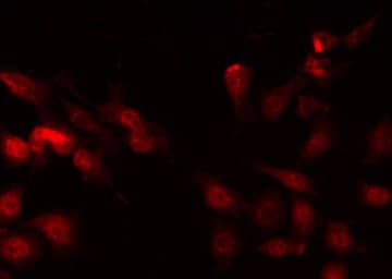 Polyclonal Rabbit anti-Human ZEB2 / SIP-1 Antibody (IHC, IF, WB)