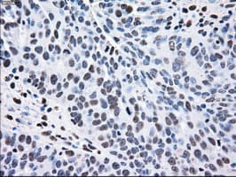 MAP2K2 / MKK2 / MEK2 Antibody (clone OTI8G6)