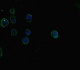 SMAD5 Antibody