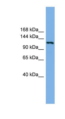 EIF4ENIF1 / 4E-T Antibody (aa143-192)