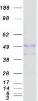 Human SLC29A2 / ENT2 Protein (Recombinant Myc-DDK (Flag))