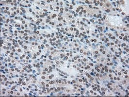 SSB / La Antibody (clone OTI2C8)