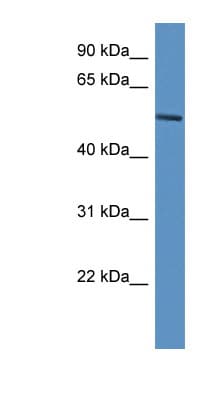 Polyclonal Rabbit anti-Human JMJD4 Antibody (C-Terminus, WB)