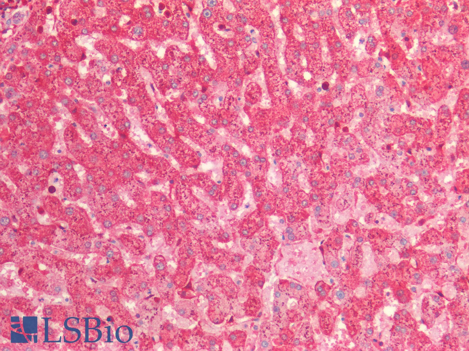 IHC-plus™ LGALS1 / Galectin 1 Antibody (aa2-135)