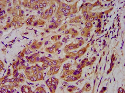 KRT1 / CK1 / Cytokeratin 1 Antibody