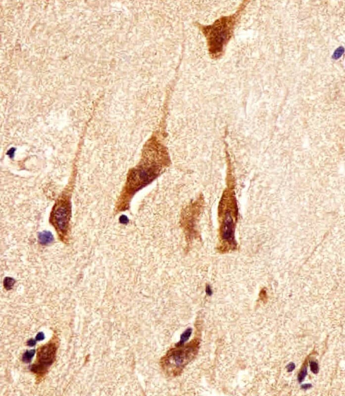 Polyclonal Rabbit anti-Human ARRB2 / Beta Arrestin 2 Antibody (aa264-298, IHC, WB)