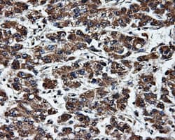 HSD17B10 / HADH2 Antibody (clone OTI10B4)