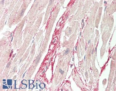 IHC-plus™ TMLHE / TMID Antibody (aa16-376)
