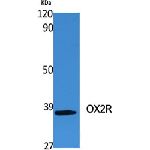 CD200R1 / CD200R Antibody (210-290 aa, C-terminal)