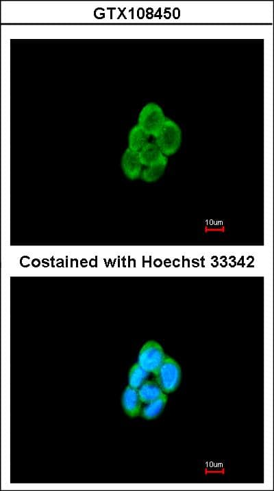 CMTM6 / CKLFSF6 Antibody (aa119-183)