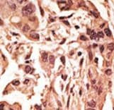 SIRT6 / Sirtuin 6 Antibody (aa290-319)