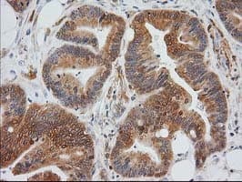 MAPRE2 / EB2 Antibody (clone OTI5F3)