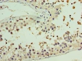 AASDHPPT / LYS5 Antibody (aa1-309, Biotin)