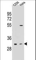 OR5L2 Antibody (aa62-90)