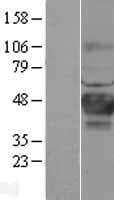CA12 / Carbonic Anhydrase XII Protein (Over-Expression Lysate Myc-DDK (Flag))