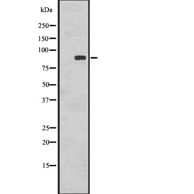 RPS6KA1 / RSK1 Antibody (phospho-Thr359,pSer363)
