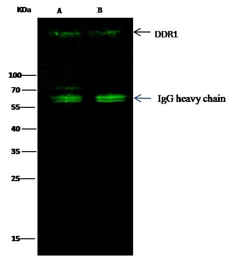 Polyclonal Rabbit anti-Human NEP / DDR1 Antibody (Preservative Free, WB)