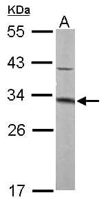 MTAP Antibody (aa1-283)