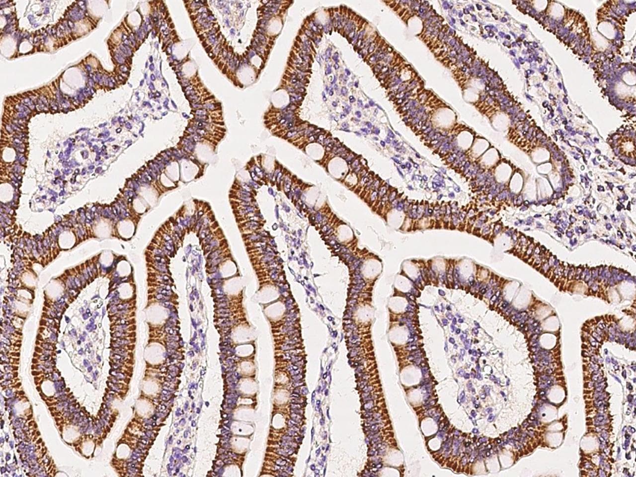FH / Fumarase / MCL Antibody