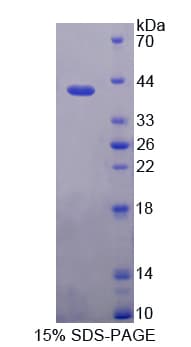 Human KRT6C / CK6C / Cytokeratin 6C Protein (Recombinant His-T7)