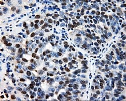 RIP1 / RALBP1 Antibody (clone OTI6C6)