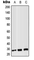 CD8B / CD8 Beta Antibody (Internal)