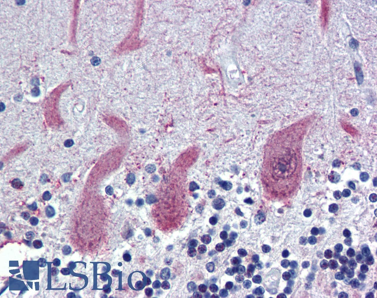 ST18 Antibody (aa899-948)