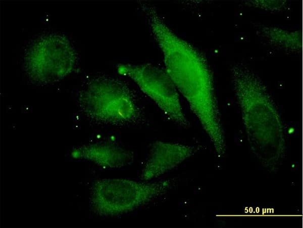 Monoclonal Mouse anti-Human MAPRE2 / EB2 Antibody (clone 4D7, IF, WB)