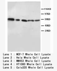 AKT1 + AKT2 Antibody (N-Terminus)