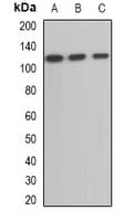 Polyclonal Rabbit anti-Human OGDH Antibody (IF, WB)