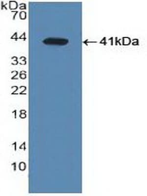 NR1H3 / LXR Alpha Antibody (aa95-434)
