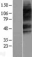 VPAC2 / VIPR2 Protein (Over-Expression Lysate Myc-DDK (Flag))