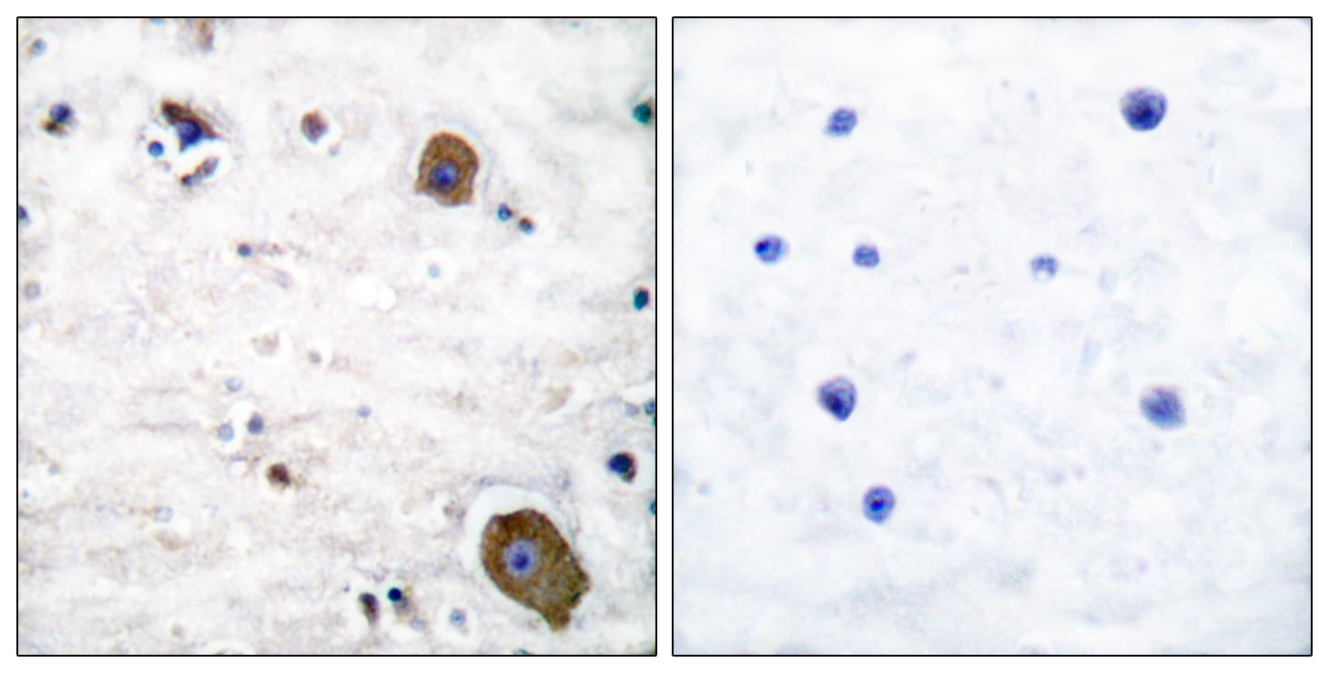 GFRA1 / GFR Alpha Antibody (aa51-100)