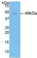 KRT18 / CK18 / Cytokeratin 18 Antibody (aa1-423, PE)