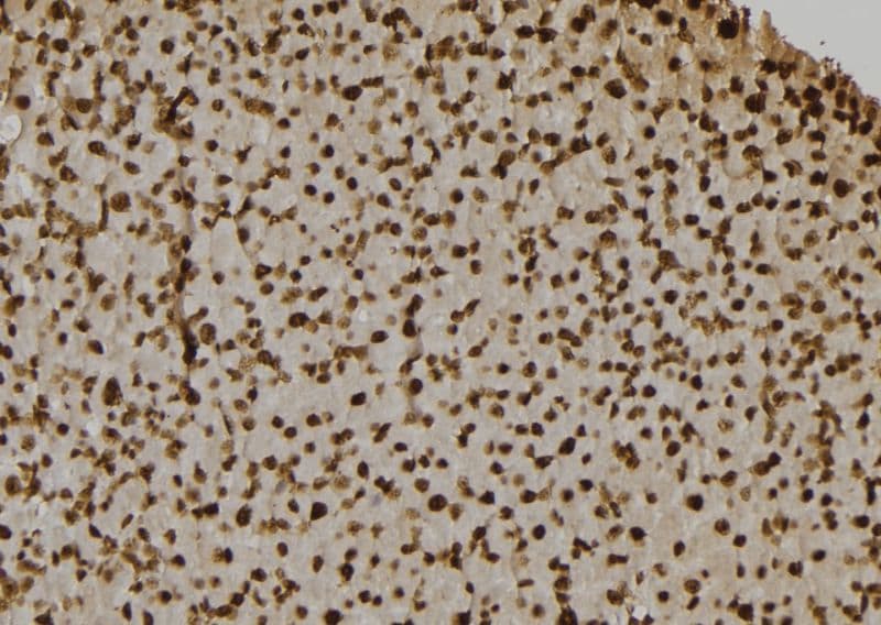 CASP7 / Caspase 7 Antibody