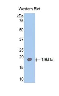ALK2 / ACVR1 Antibody (aa208-340)