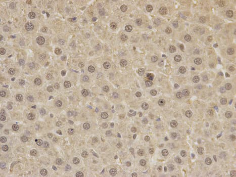 Polyclonal Rabbit anti-Human PAX3 Antibody (IHC, IF, WB)